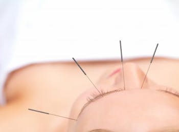 Acupuncture at Sea Photo